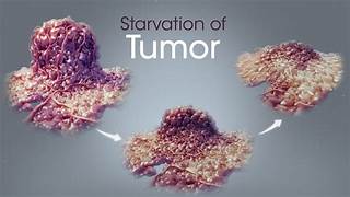 Read more about the article How To Starve Cancer