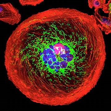 Read more about the article Kill Cancer Stem Cells!